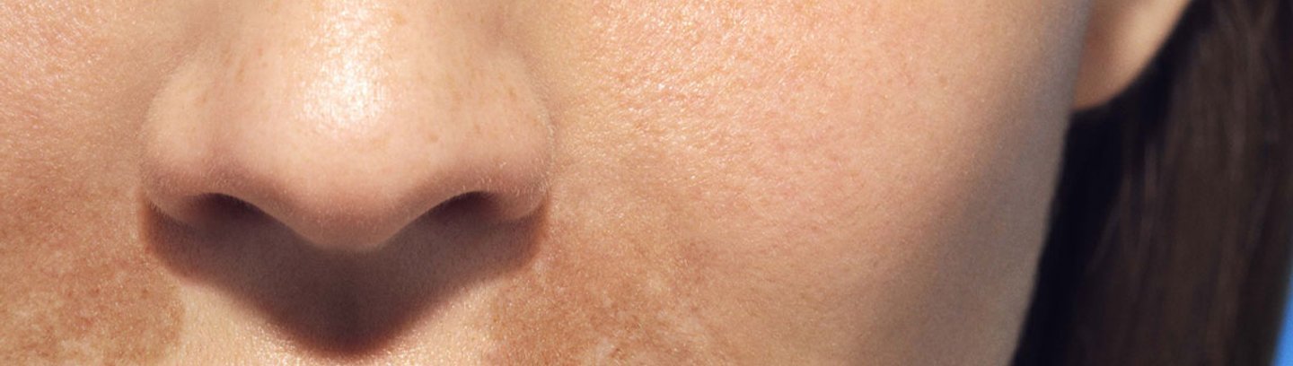 LarocheposaySubCategoryPageSunSunpigmentation
